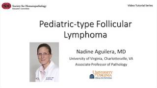 PediatricType Follicular Lymphoma [upl. by Airtemad]