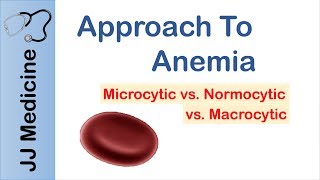 Anemia  Microcytic vs Normocytic vs Macrocytic [upl. by Andrews302]