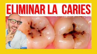 ⚠️Como se hace un EMPASTE DENTAL ✅ Reconstrucción clase I y II [upl. by Waly799]