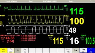 MH Vitals [upl. by Rosenfeld]