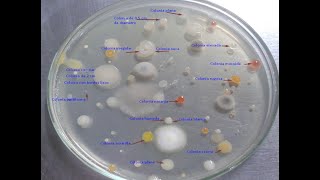 Morfología colonial de bacterias [upl. by Ameyn]