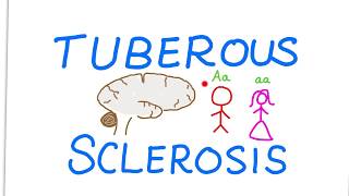 Tuberous Sclerosis Complex TSC [upl. by Katine]