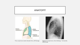 Mediastinal Masses [upl. by Yelich522]