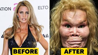 20 WorstPlastic Surgery Disasters [upl. by Alekim]