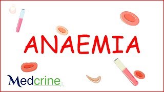 Anemia  causes classification clinical features treatment [upl. by Nagaer342]