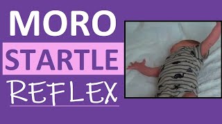 Moro Reflex Newborn Test  Startle Reflex  Pediatric Nursing Assessment [upl. by Godliman946]