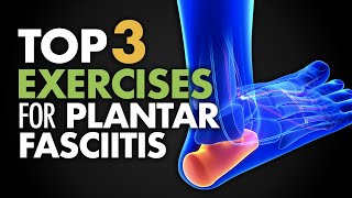 How to Fix Plantar Fasciitis FOREVER [upl. by Navanod]