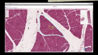 Histology Helper  Muscle Histology [upl. by Ichabod867]