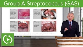 Group A Streptococcus GAS – Infectious Diseases  Lecturio [upl. by Atinaw]