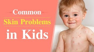 6 Common Skin Problems in Children [upl. by Ginsberg]