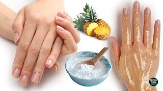 How To Remove Wrinkles From Hands Naturally in 2 Days [upl. by Rybma]