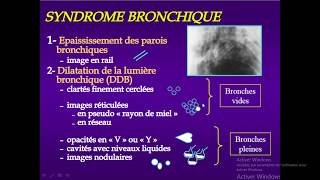 syndrome bronchique partie 03 DDB [upl. by Obaza]