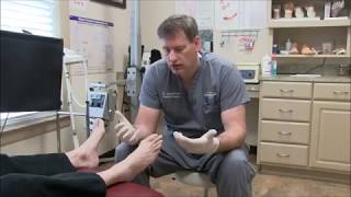 Treating Toenail Fungus with Lamisil [upl. by Liryc]