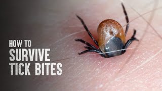 How to Survive Tick Bites [upl. by Calabrese]