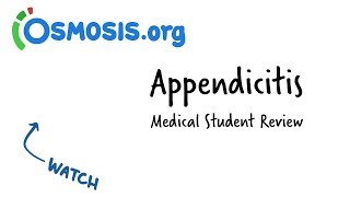 Appendicitis  Clinical Presentation [upl. by Demmer]