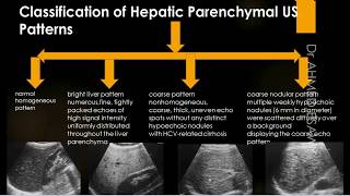 Liver Ultrasound Diffuse Disease Cirrhosis  fibrosis  Scoring  Hepatitis  Autoimmune  Contra [upl. by Reffinej]