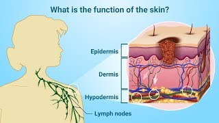 Understanding Melanoma [upl. by Brockwell]