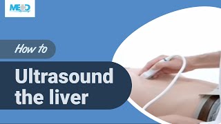 How to ultrasound the liver [upl. by Ringler849]