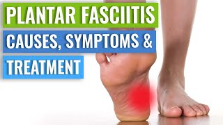 Plantar Fasciitis  Diagnosis And Treatment [upl. by Ahsinod9]