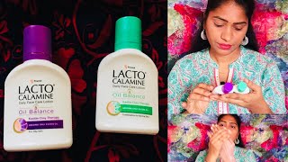 Lacto Calamine Review In தமிழ் [upl. by Heyman]