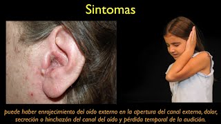 otitis externa ESPANOL [upl. by Yenot429]