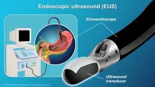 Understanding EUSFNA [upl. by Trawets]