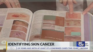 VIDEO How to identify skin cancer [upl. by Annadroj]