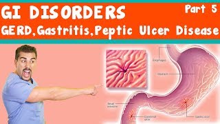 Gastro Esophageal Reflux Disease Causes Symptoms amp Treatment Fortis Healthcare Bangalore India [upl. by Pontius]