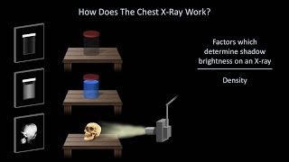 Chest x ray  How to read a Chest x ray TIPS [upl. by Foley996]