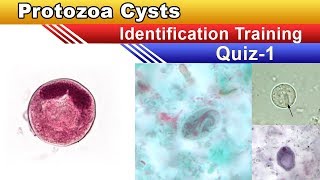 Protozoa Cysts Identification Training Quiz  Part 1 [upl. by Estus]