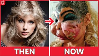 20 Famous Celebrities Unrecognizable After Plastic Surgery Gone Wrong [upl. by Corbie795]