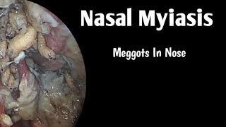 Myiasis and Scabies [upl. by Alhsa565]