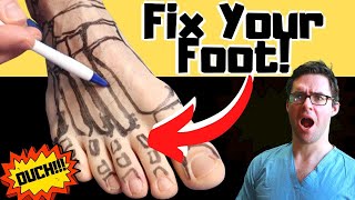 Broken Foot Recovery amp Foot Fracture Home Treatments Top 25 Hacks [upl. by Enalda]