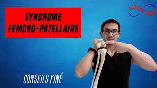 Soigner efficacement le syndrome fémoro patellaire  Conseil KINE et autoexercices [upl. by Huntley]