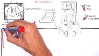 Acute Coronary Syndrome DETAILED Overview MI STEMI NSTEMI [upl. by Ayanaj805]