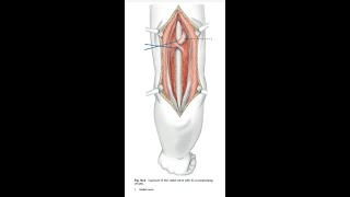 Posterior Approach to Humerus [upl. by Johann120]