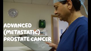 About Advanced Metastatic Prostate Cancer [upl. by Otinauj]