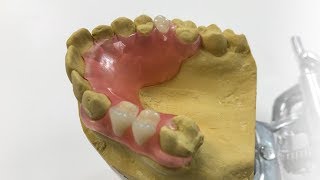 How To Make A Fiber Flex™ Partial  The Entire Process  Dental Lab Learning [upl. by Munson]