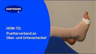 Puetterverband an Ober und Unterschenkel [upl. by Corabel784]