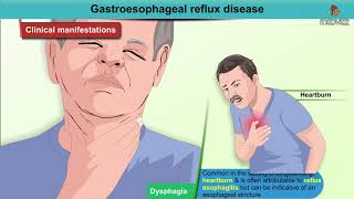 Curing GERD and Acid Reflux 8 Common cause of Acid Reflux and GERD Part 1 [upl. by Ahsinek]