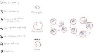 7 Types of Anaemia [upl. by Guy]