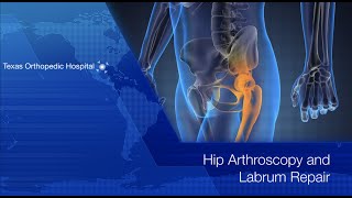 Anterior Labral Tear Test⎟Labral Tear [upl. by Tessy]