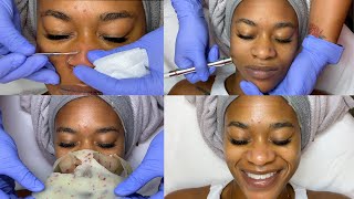 Double Exfoliation Facial w Microdermabrasion  GlamByLiaLeigh [upl. by Itagaki354]