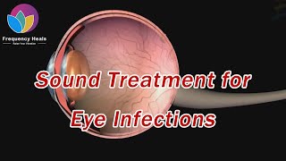 Sound Treatment for Eye Infections  Healing Frequencies  Frequency Heals [upl. by Ecnerrot151]