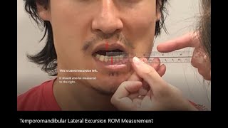 Range of Motion Temporomandibular TMJ Lateral Excursion [upl. by Deeann]