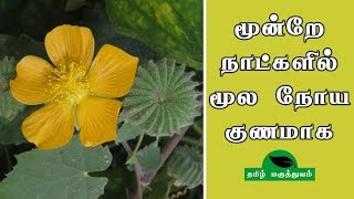 மூன்றே நாட்களில் மூல நோய் குணமாக  Thuthi ilai uses in Tamil  Abutilon Indicum for Piles [upl. by Taber246]