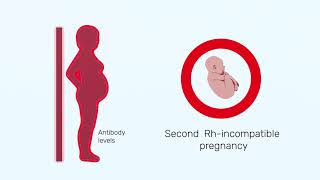 How Rh factor affects a pregnancy [upl. by Ayotahc]