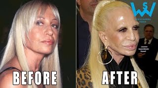 Worst celebrity plastic surgery disasters  Plastic surgery fails [upl. by Pasadis]