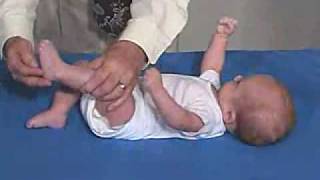 Neurology Exam 3 Month Primitive ReflexesGrasp [upl. by Spike]