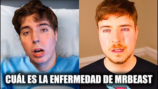 Cuál es LA ENFERMEDAD que tiene MRBEAST [upl. by Asirralc]